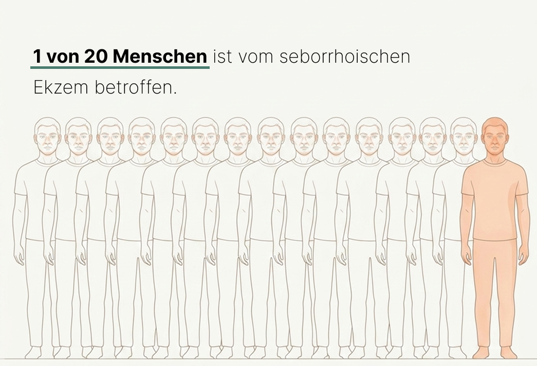 einer von zwanzig menschen ist vom seborrhoischen ekzem betroffen